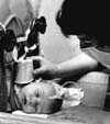 Polio